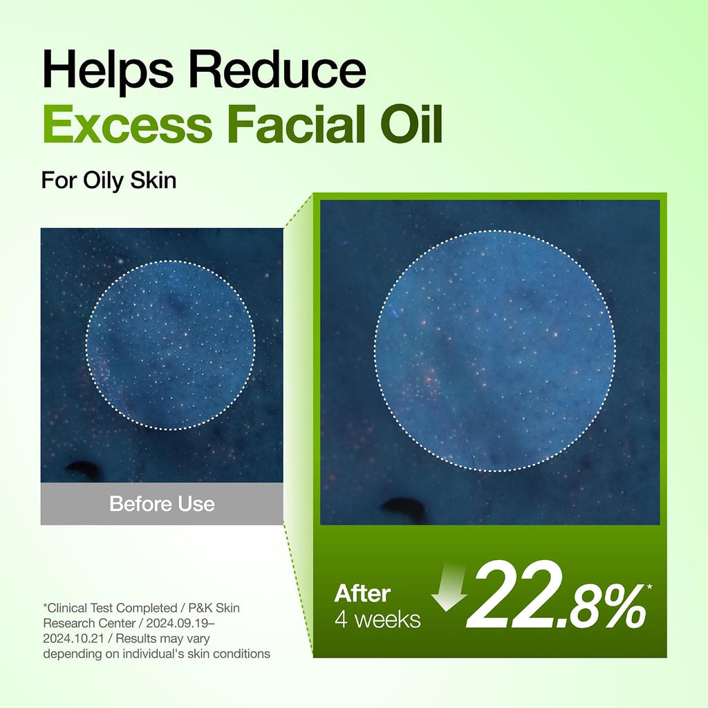 Azelaic Acid 10 Hyaluron Redness Soothing Serum, 1.01 Fl Oz | Facial Serum for Blemish-Prone & Oily-Prone Skin, Lightweight & Hydrating Blemish Care, Hyaluronic Acid, Korean Skincare